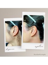 ブラジリアンワキシング シックスナイン(BrazilianWaxing69)/女性 / もみあげ