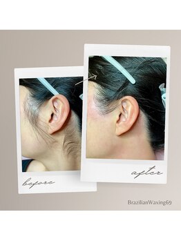 ブラジリアンワキシング シックスナイン(BrazilianWaxing69)/女性 / もみあげ