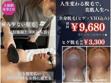 ノノケケ(NONOKEKE)