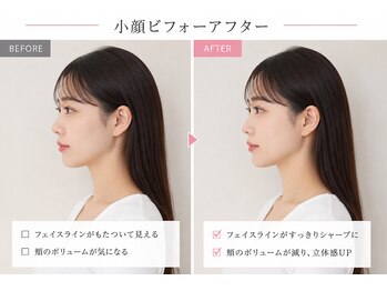 ベアフット(BARE FOOT)/20代後半から顔の余白対策