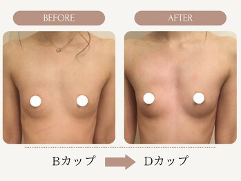 ウェルバスト(Well Bust)/【バストアップ例】B→Dカップ