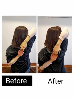 アース エンジェル整体院/ビフォアフ 肩甲骨はがし