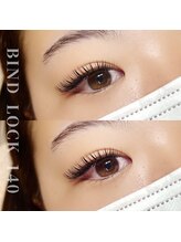 アネラ(ANELA)/バインドロック140束