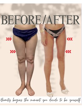 エイエービジュー(Aa.bijou)/Aa.bijouオーナーの2年の変化