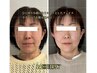 【マスク外したくないあなたへ】小顔矯正&ヘッドスパ引き上げスッキリケア
