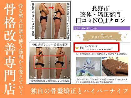 サンティエールの写真