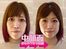 ネルジム 札幌店(NERU GYM)/中顔面・人中短縮を実現！