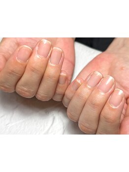 爪の悩みを解消できる（ケア含む）