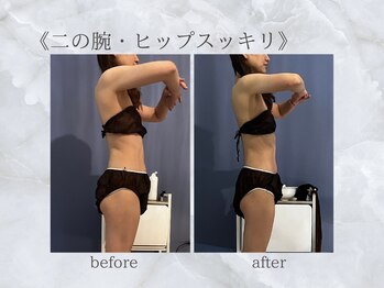 ジュプン 長崎/ブライダルのお客様