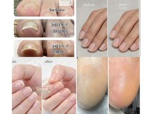 ネイラックス(Nailax)の雰囲気（巻き爪やフットケア，自爪育成も大好評！）