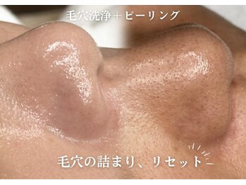 フジモトサロン 那覇おもろまち店(fujimotoサロン)の写真/那覇の毛穴洗浄エステ｜黒ずみ・毛穴詰まり・開き毛穴を徹底ケア◎ノーファンデ肌管理で素肌に自信