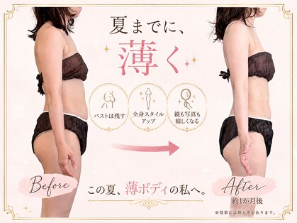 リュシータ 吹田千里丘店(LUSHEETA)の写真
