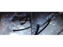 シルフ エルスパ 阪急茨木店(Sylph &EirSPA)/