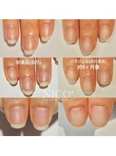 ニコプラス(NICO+)/自爪育成中
