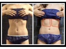 サバーイ サバーイ(SABAHI SABAHI)/熊本希少！筋肉増強マシン