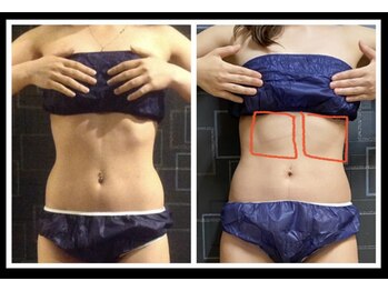 サバーイ サバーイ(SABAHI SABAHI)/熊本希少!筋肉増強マシン