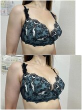 バーディー(BIRDIE)/施術１回/4０代