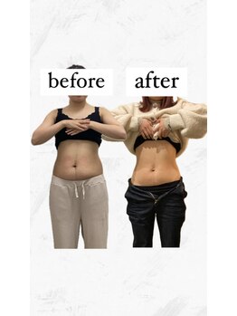 ビーアイリー(Be irie)/酵素ファスティング×痩身エステ