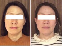 美容整体 ウェリナ 蟹江院/小顔矯正/骨盤矯正/美脚サロン