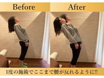 ビカミング整体院(美coming整体院)/ビフォーアフター
