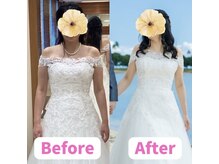 ボディキュア ブライダル美容整体 大阪梅田/【姿勢改善×ー5kg】ドレス映え