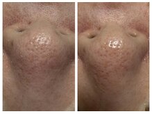 ルシアル(LUCIALL)/