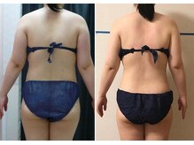 ヘルシースリムなにわ/リンパ整体　90分　たまにメンテ