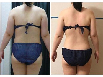 ヘルシースリムなにわ/リンパ整体 90分 たまにメンテ