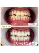 ルブラン 奈良店(Le Blanc)/回数重ねるほど白く！！