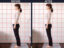 さいとう治療院 新百合ヶ丘/反り腰・骨盤のゆがみ