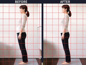 さいとう治療院 新百合ヶ丘/反り腰・骨盤のゆがみ