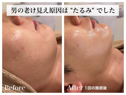 シャルム(Charme)の写真