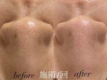 リスポアラボ(LIS PORE.LAB)/