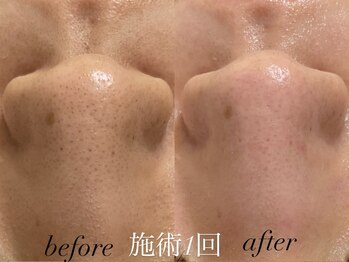 リスポアラボ(LIS PORE.LAB)/