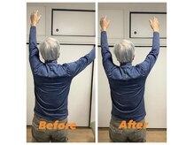 マコア 入谷店(Macore)/肩が上げづらかった方　初回施術