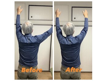 マコア 入谷店(Macore)/肩が上げづらかった方　初回施術