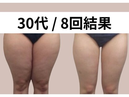 リストアミー(Restore me)の写真