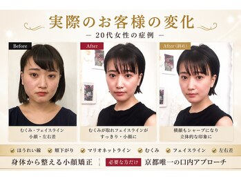 サロンチオリ 烏丸(Salon Chiori)の写真/顔のゆがみ、身体のバランスを整え、輪郭の凸凹をなめらかに。自然で上品な小顔印象へ導く本格矯正。