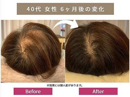 リアン 目黒(Re-Ane)の写真