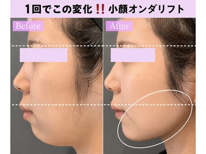 カンナムビューティー 上野店の写真