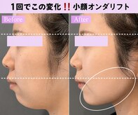 カンナムビューティー 上野店