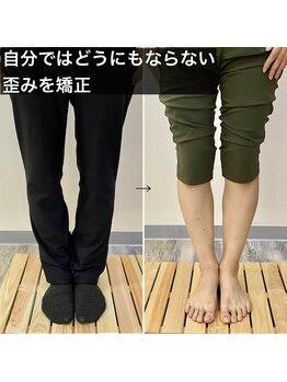 横浜DRT矯正院/弘明寺で評判のO脚・美脚矯正