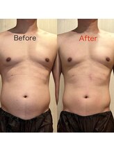 アリッチ 岡崎店(a.Rich)/マシンたった10分1回の劇的変化!