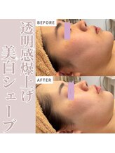 シェービングアンドエステ ブランピュア(Blanc pur)/一回でもトーンUP効果！