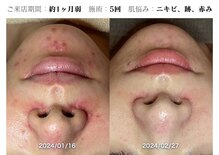 コキュウ お顔ラボ(KOKYU お顔LABO)