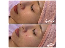 サロン ド ビジュー(Salon de Bijou)の雰囲気（艶肌Wax認定サロン☆Wax＋エレクトロポレーションコース人気です）