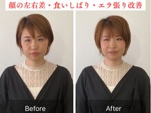 チャンス 西院(chance)の雰囲気（【Google口コミ120件以上◎】エラ張り/食いしばり/顔の歪み改善）