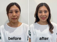 サラ デ ミレ(Sala de milae)/トータルビューティーコース