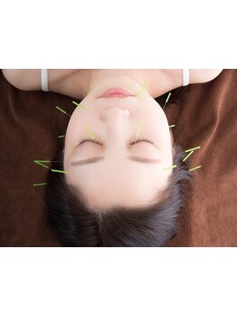 鍼灸施術を受けたい