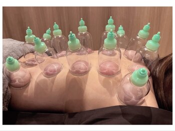 いつき整体院 樫原店/地域最安値☆吸玉カッピング